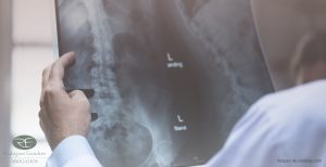 Secuelas accidentes de trafico