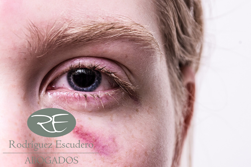 Rodriguez Escudero abogado delito lesiones Majadahonda